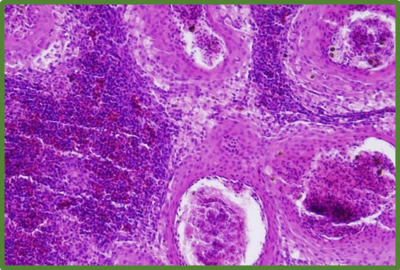 Francisella noatunensis