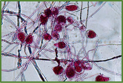 Phytophthora parasitica