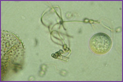 Benjaminiella poitrasii