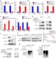 LINC00470 inhibited HK1 ubiquitination to affect glycolysis by positively regulating AKT activation.jpg