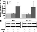 SiRNA of lncRNA RGMB-AS1 promoted the expression of RGMB in A549 and SPC-A-1 cells.jpg
