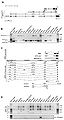 Splicing isoforms and expression pattern of NPPA and NPPA-AS.jpg