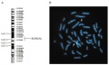 Chromosomal localization of the BCMSUNL gene.jpg