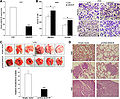 Effects of ''BANCR'' overexpression on tumor metastasis in vivo.jpg