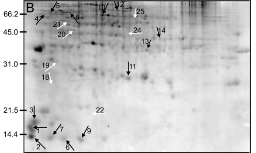 IC4R009-Proteomic-2007-17385905-f2b.png