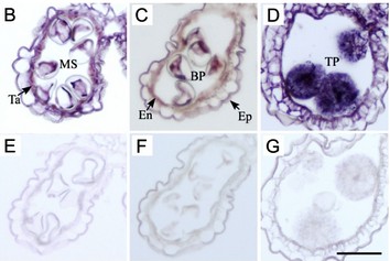 Gene expression pattern of CAP1. (2).jpg