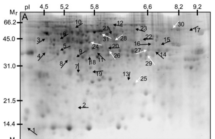 IC4R009-Proteomic-2007-17385905-f3a.png