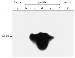 Fig. 1 Northern blot analysis of the RTS gene.