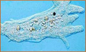 Acanthamoeba keratitis